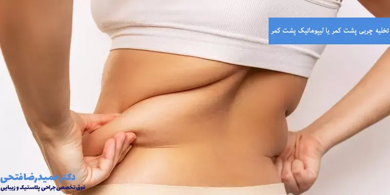 تخلیه چربی پشت کمر یا لیپوماتیک پشت کمر