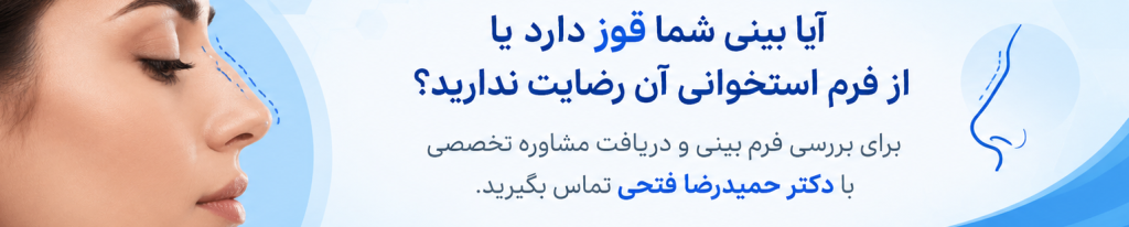دریافت مشاوره از دکت فتحی بینی استخوانی
