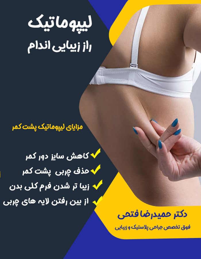 لیپوماتیک کمر