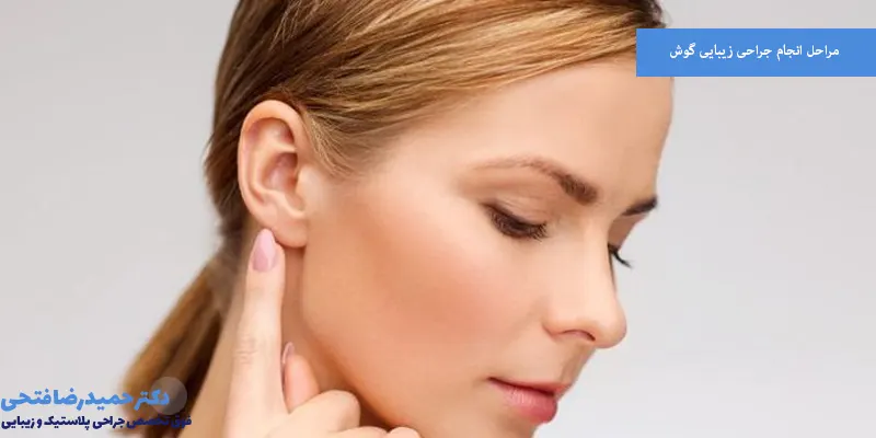 مراحل انجام جراحی زیبایی گوش