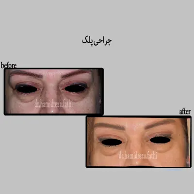 نمونه-کار-بلفارو