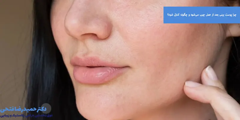 چرا پوست بینی بعد از عمل چرب می‌شود و چگونه کنترل شود؟
