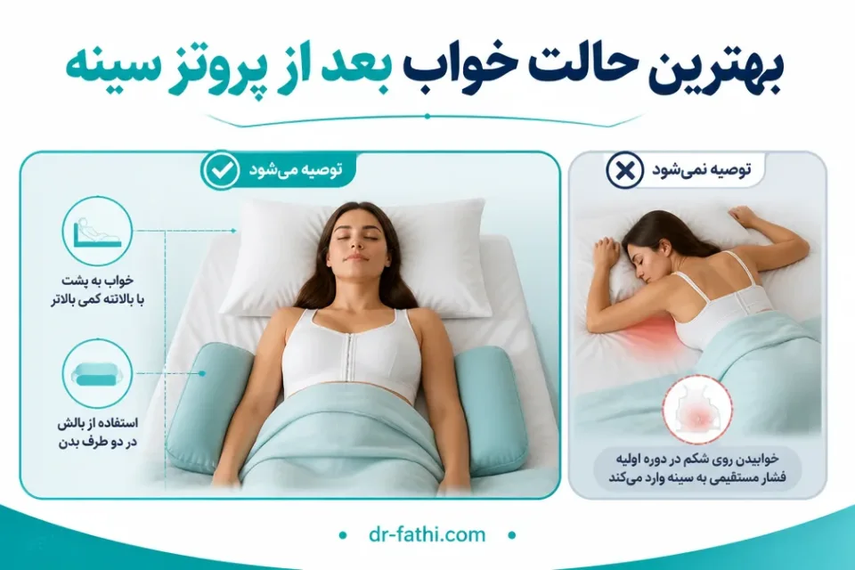 نمای توضیحی درباره بهترین حالت خواب بعد از پروتز سینه