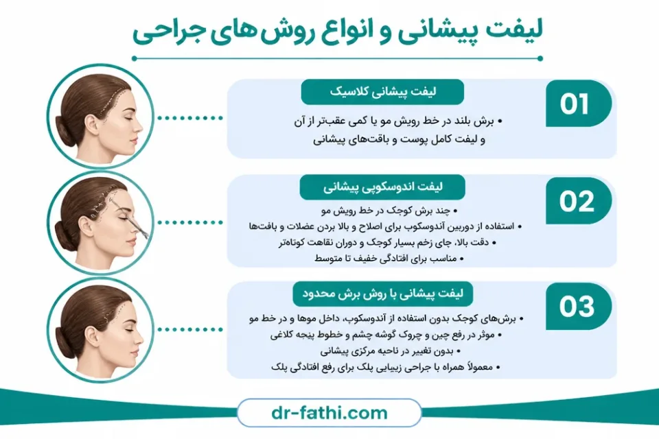 نمای توضیحی درباره انواع روش های لیفت پیشانی