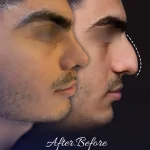 جراحی بینی نمونه کار