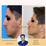 جراحی های زیبایی و جراحی پلاستیک