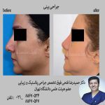 جراحی های زیبایی فوق تخصص جراحی پلاستیک و زیبایی