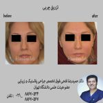 فوق تخصص جراحی پلاستیک و زیبایی