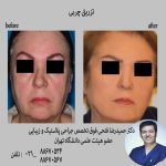 جراحی های زیبایی فوق تخصص جراحی پلاستیک