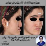 شکاف کام و لب